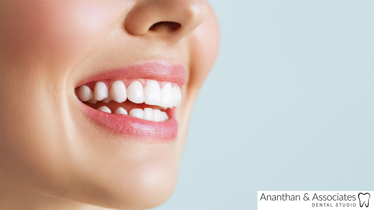 What Does it Mean to Have Translucent Teeth