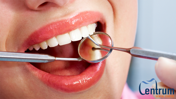 A mouth opening up at a dental exam.