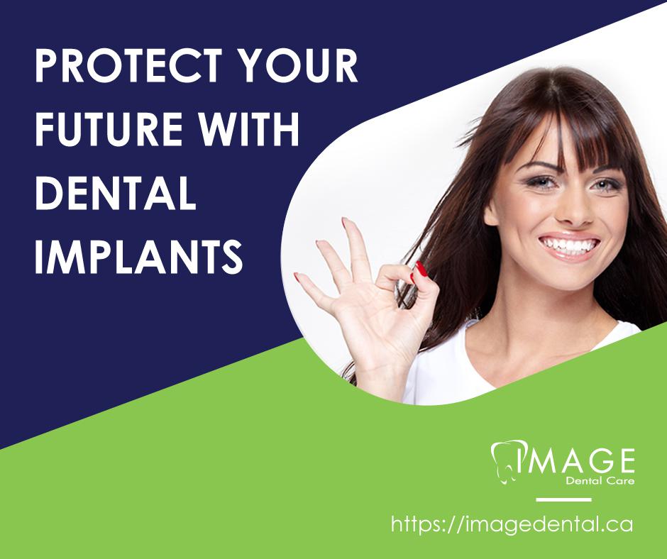 Protect Your Future with Dental Implants — Image Dental Family
