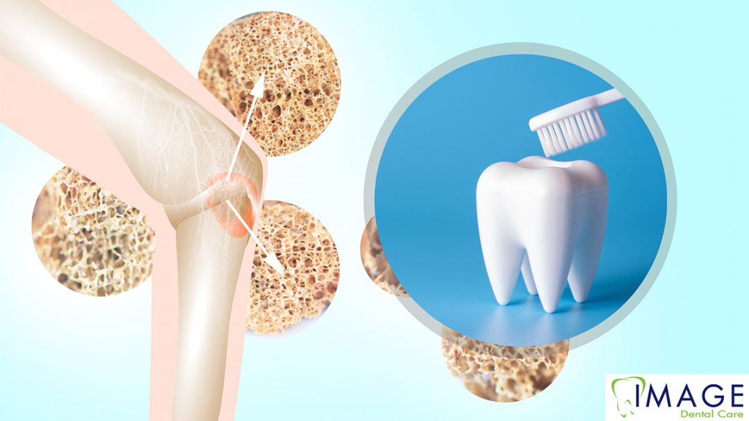 Dental Care and Rheumatoid Arthritis Image Dental
