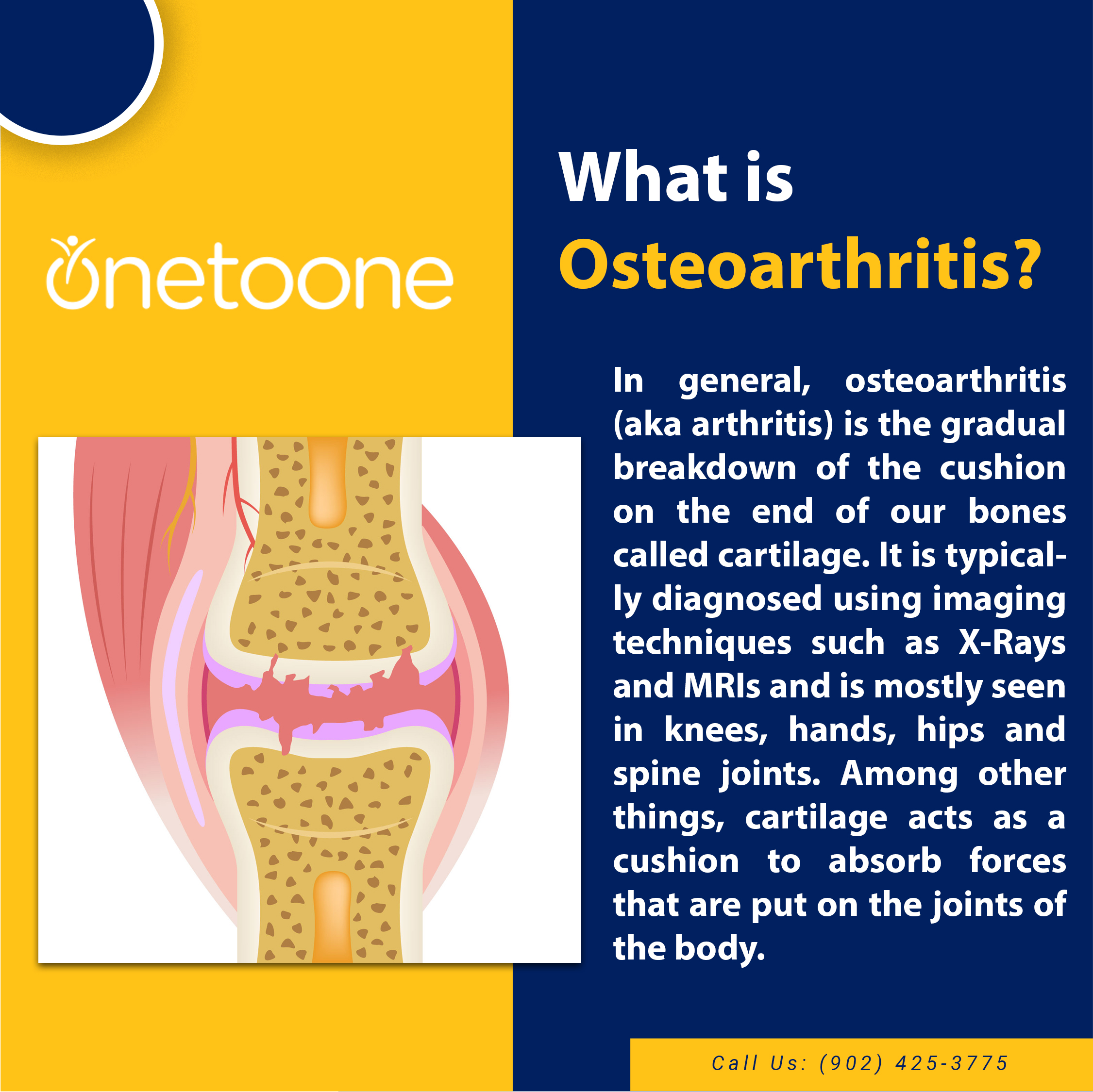 What Is Osteoarthritis One To One Wellness In Halifax NS