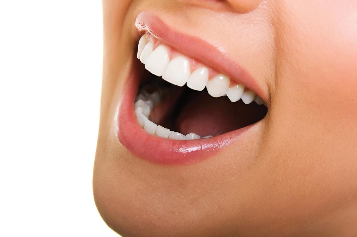 Teeth Whitening Guide Dentist in Brandon MB